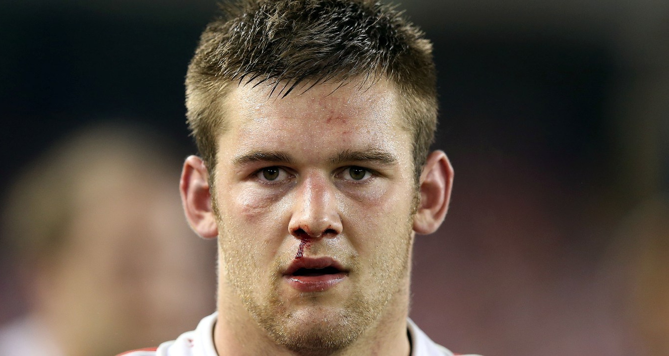 Lydiate is ready for battle Lydiate is ready for battle